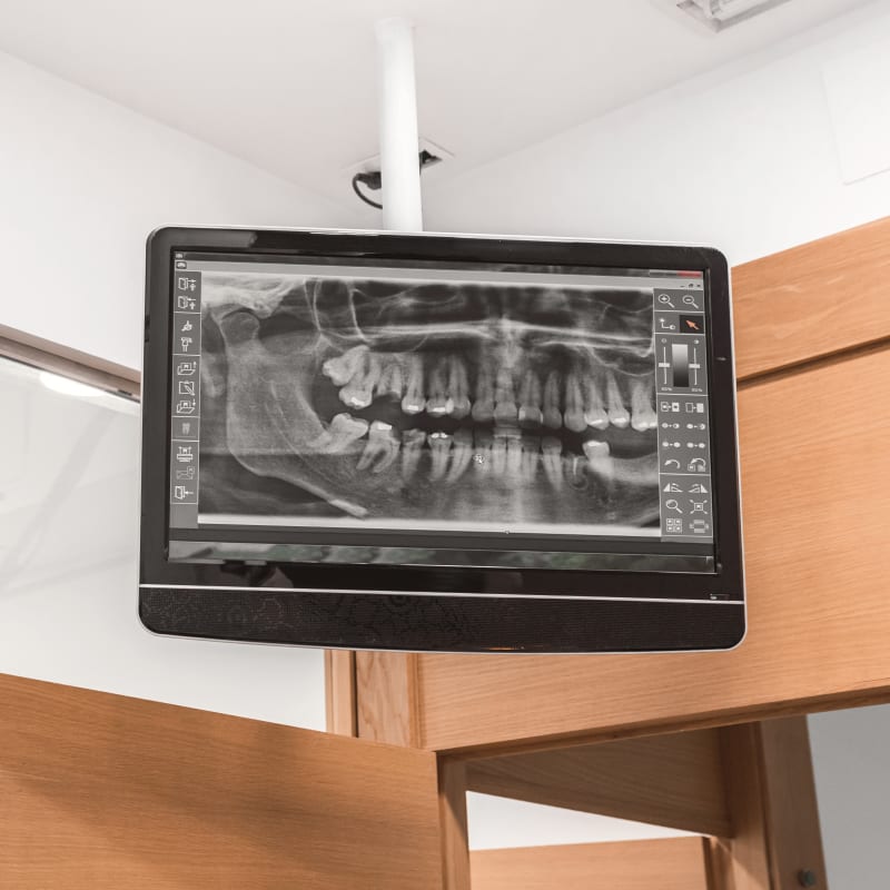 Dental Technology, Caledon East Dentist